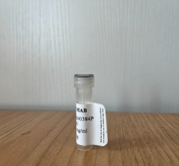 Troponin I Monoclonal Antibody A34600384P