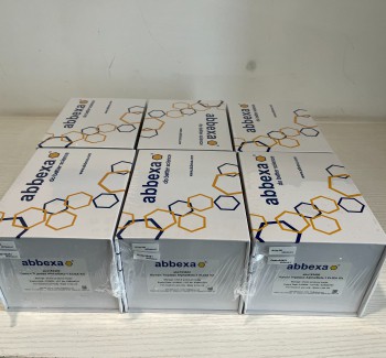 Human Tryptase Alpha/Beta-1 (TPSAB1) ELISA Kitabx153400